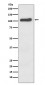 Anti-ACE2 Rabbit Monoclonal Antibody